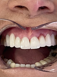 DentAntalya (Oral & Dental Health Clinic)