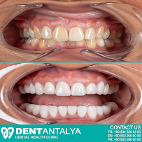 DentAntalya (Oral & Dental Health Clinic)