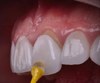 DentAntalya (Oral & Dental Health Clinic)