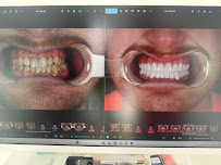 DENTAL DESIGN TURKEY (Dentist Antalya, Dental Treatments, Implants, Veneers, Smile Makeover, Cosmetic Dentistry)
