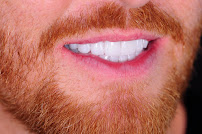 DENTAL DESIGN TURKEY (Dentist Antalya, Dental Treatments, Implants, Veneers, Smile Makeover, Cosmetic Dentistry)