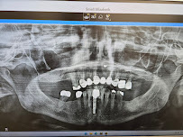 Umut Dental Clinic Antalya