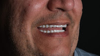 Umut Dental Clinic Antalya