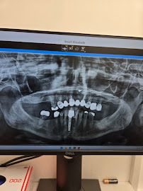 Umut Dental Clinic Antalya