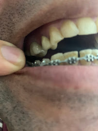 Umut Dental Clinic Antalya