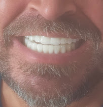 Zorlu Diş Polikliniği | Center Dental Clinic