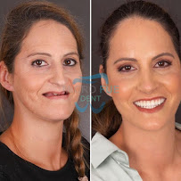 Dentist in Antalya