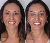 Dentist in Antalya