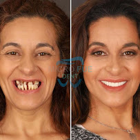 Dentist in Antalya