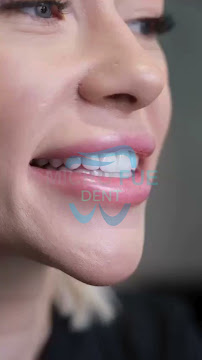 Dentist in Antalya