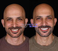 Dentist in Antalya