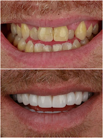 Dentist in Antalya