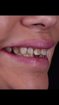Dentist in Antalya