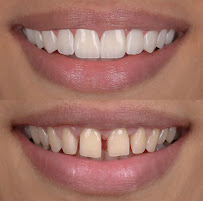 Dentist in Antalya