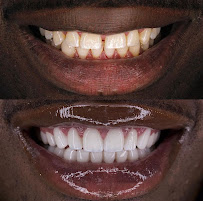 Antalya Dental Clinic in Antalya