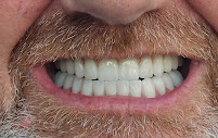 Antalya Akdeniz Dental Clinic Perge Şubesi
