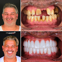 Antalya Dent Smile (Dental Implants, Crowns, Veneers & Invisalign)