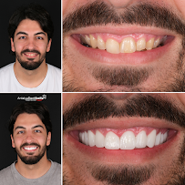 Antalya Dent Smile in Antalya