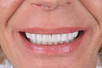 Dentgroup Antalya-Lara Diş Kliniği