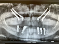 Dentgroup Antalya-Lara Diş Kliniği