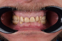 Dentgroup Antalya-Lara Diş Kliniği