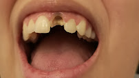 Dentgroup Antalya-Lara Diş Kliniği