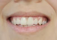 Dentgroup Antalya-Lara Diş Kliniği