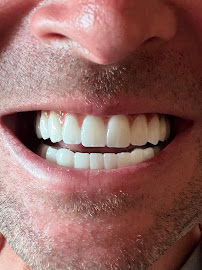 Dentgroup Antalya-Lara Diş Kliniği