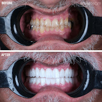 Smile Team Turkey - (Dental Implants, Crowns, Veneers & Teeth Whitening)