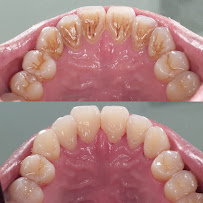 Hydro Medical Dental Care Batu Bolong - Dentist|Teeth Whitening|Teeth Scaling|Tooth Filling|Veneers Clinic Near Canggu