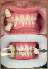 Hydro Medical Dental Care Batu Bolong - Dentist|Teeth Whitening|Teeth Scaling|Tooth Filling|Veneers Clinic Near Canggu