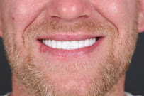ES Clinic Turkey | Excellent Smile Clinic