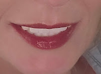 ES Clinic Turkey | Excellent Smile Clinic