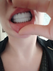 ES Clinic Turkey | Excellent Smile Clinic