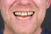 ES Clinic Turkey | Excellent Smile Clinic