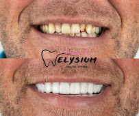 Elysium Dental Turkey