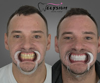 Elysium Dental Turkey