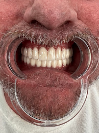 Elysium Dental Turkey