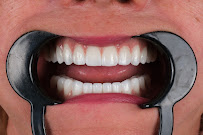 Elysium Dental Turkey
