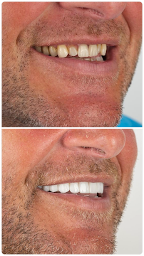 Elysium Dental Turkey