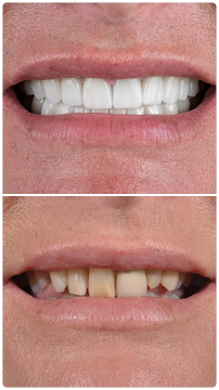Elysium Dental Turkey
