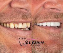 Elysium Dental Turkey