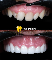 The Pearl Clinic Antalya