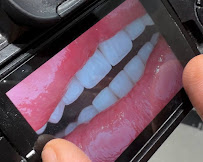 Dentalays Clinic Turkey