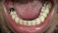 Dentalays Clinic Turkey