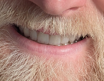 Dentalays Clinic Turkey
