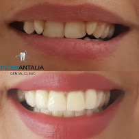 INTER Antalia ORAL AND DENTAL HEALTH CENTER