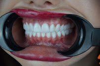 INTER Antalia ORAL AND DENTAL HEALTH CENTER