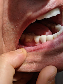 Apex Dental Clinic - Antalya