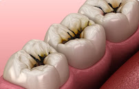 Laughter Dental Clinic